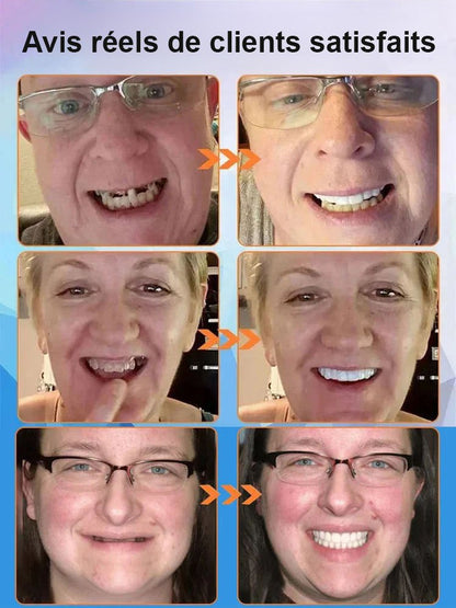 [Neue britische Entdeckung] Silikon-Zahnprothese, die Zähne imitiert 