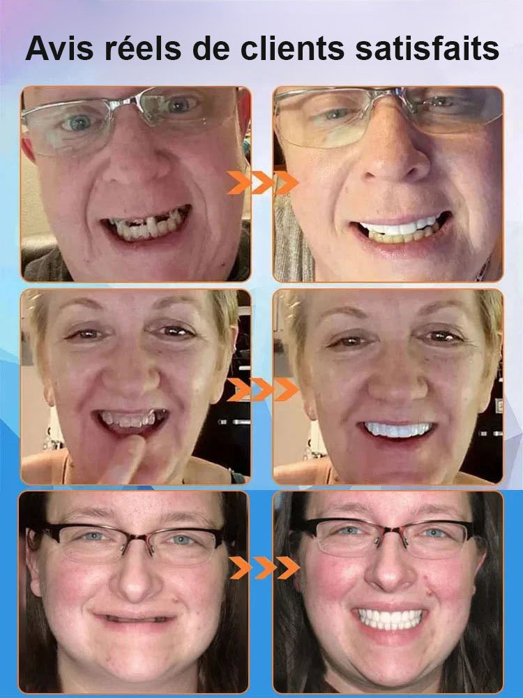 [Neue britische Entdeckung] Silikon-Zahnprothese, die Zähne imitiert 