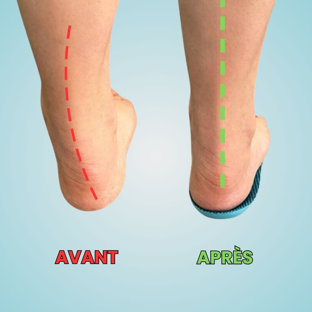 OrthoFlex™ Einlegesohlen – Ein ganzer Tag ohne Schmerzen