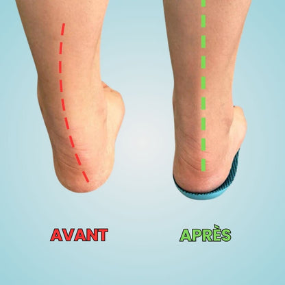 OrthoFlex™ Einlegesohlen – Ein ganzer Tag ohne Schmerzen