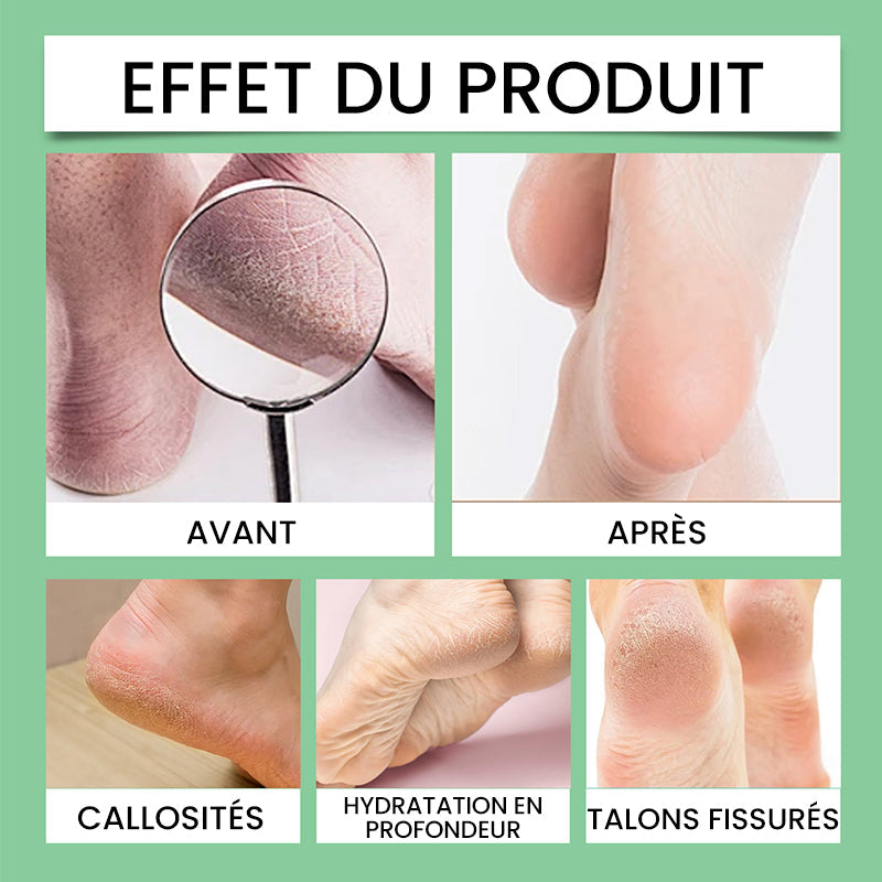 Hornhautentferner für Füße