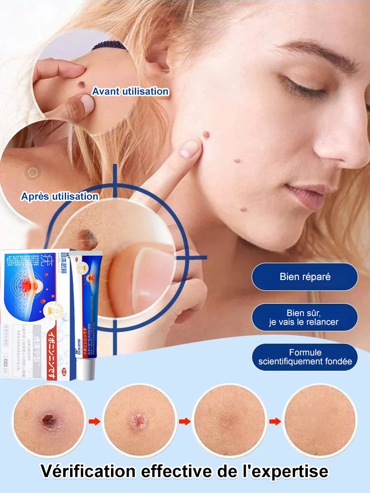 Antipyretic Verrucoqingning Medical Gel 